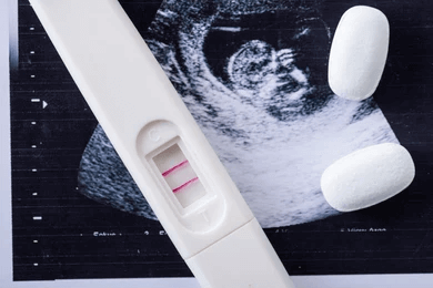 Using Cytotec for a Missed Abortion